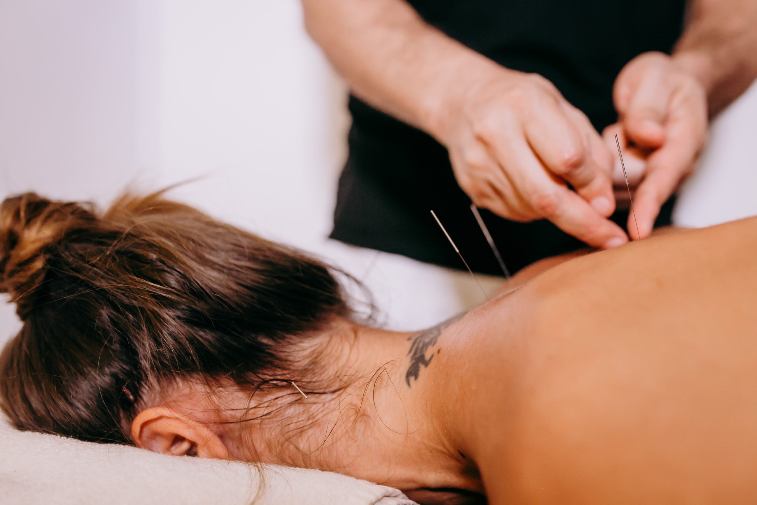 Médecine chinoise : les bienfaits de l&rsquo;acupuncture pour booster la fertilité féminine et masculine.